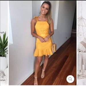 Yellow patterned dress